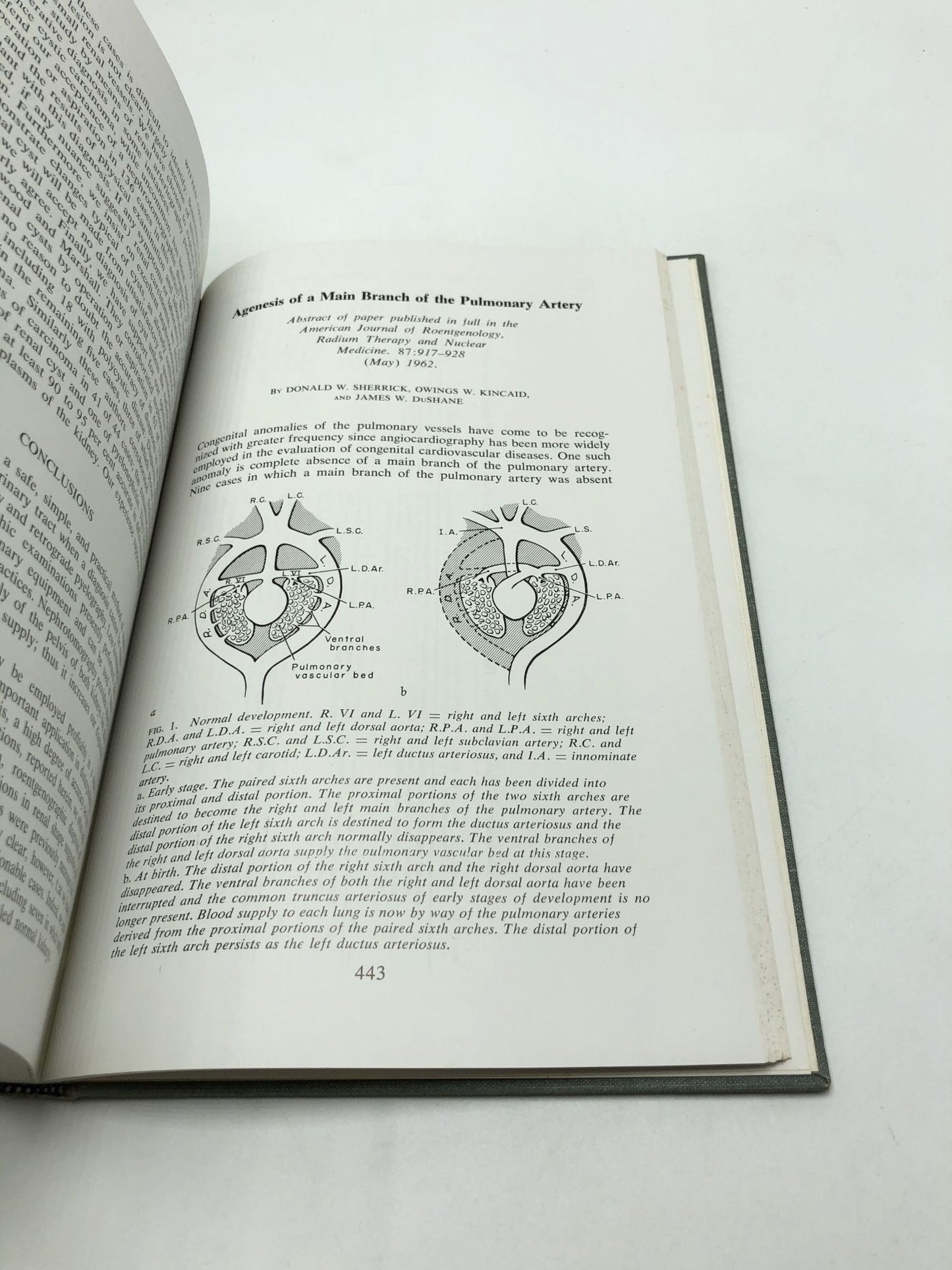 1962 - 1963 Collected Papers In Medicine From The Mayo Clinic And The Mayo Foundation, Volume 54, 1963-1964 Collected Papers In Medicine From The Mayo Clinic And The Mayo Foundation, Volume 55 (2 Volumes)