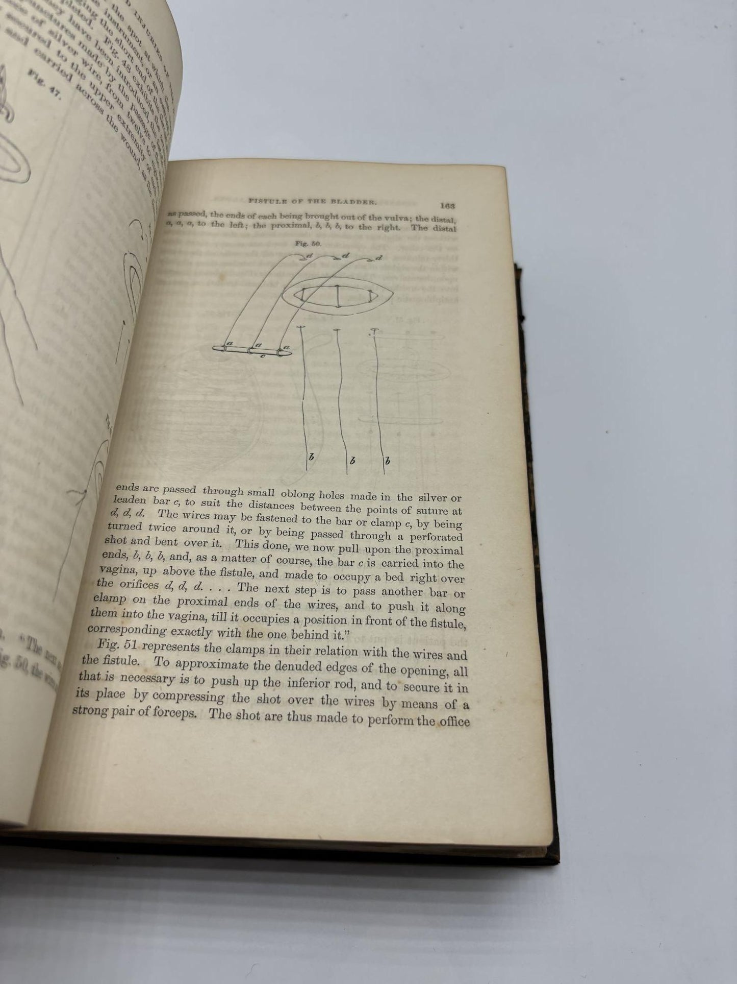 A Practical Treatise On The Diseases, Injuries, And Malformations Of The Urinary Bladder, The Prostate Gland, And The Urethra
