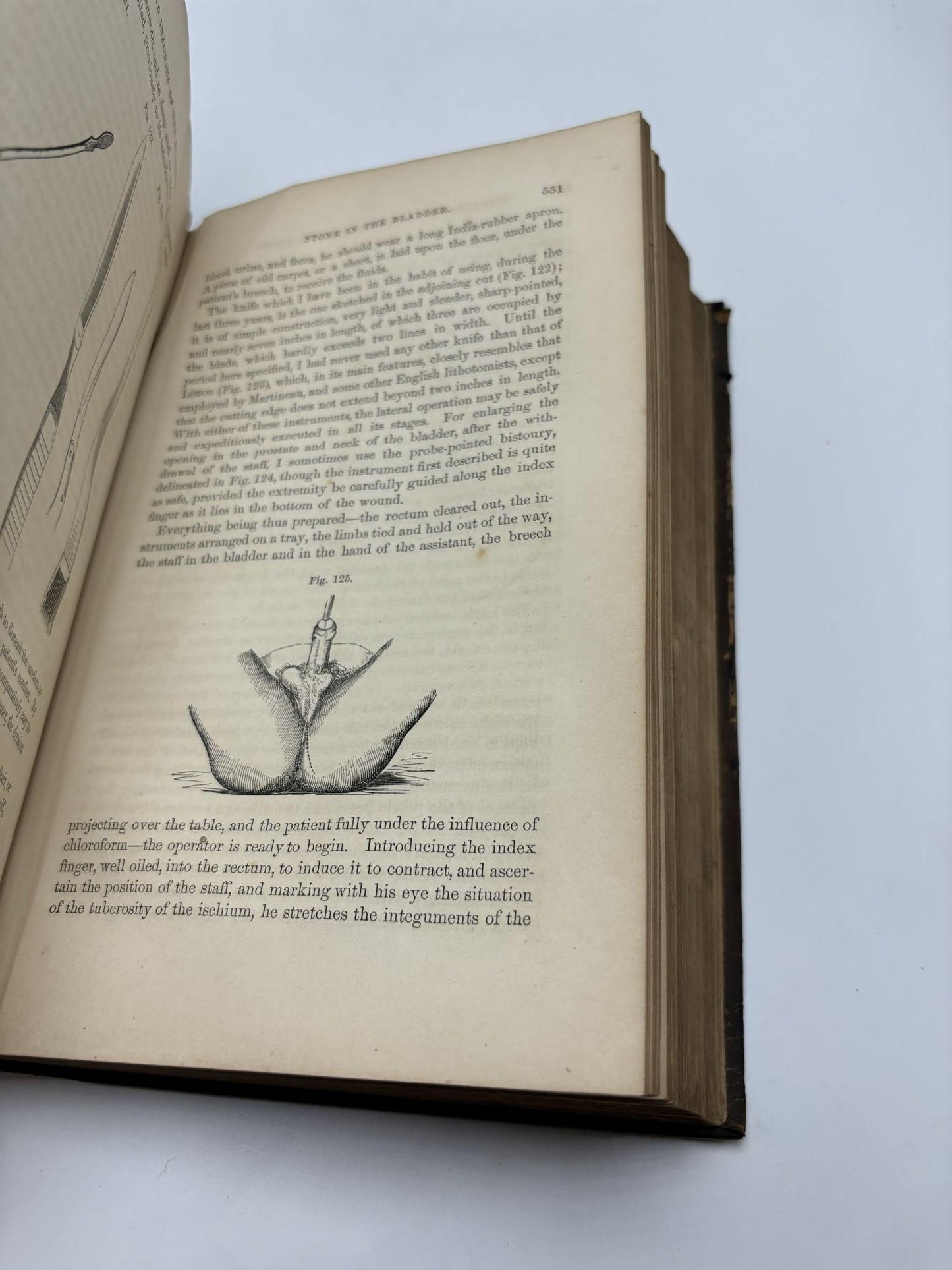 A Practical Treatise On The Diseases, Injuries, And Malformations Of The Urinary Bladder, The Prostate Gland, And The Urethra