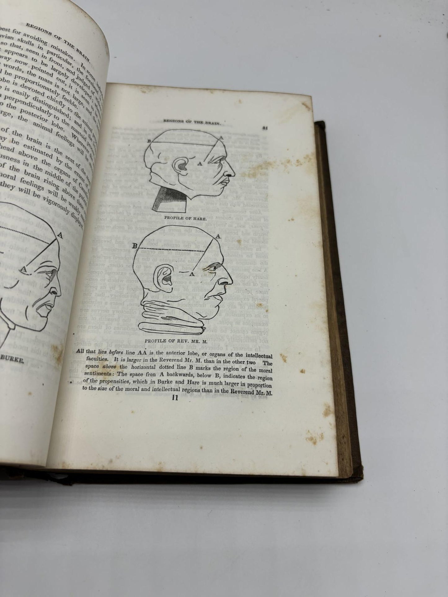 A System Of Phrenology. Sixth American From The Third Edinburgh Edition