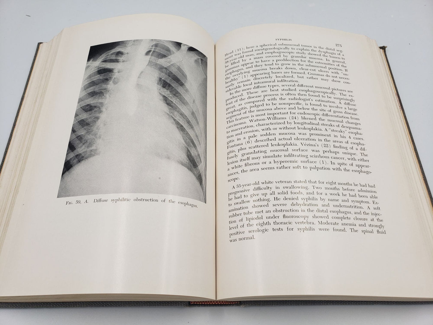 The Esophagus and Its Diseases
