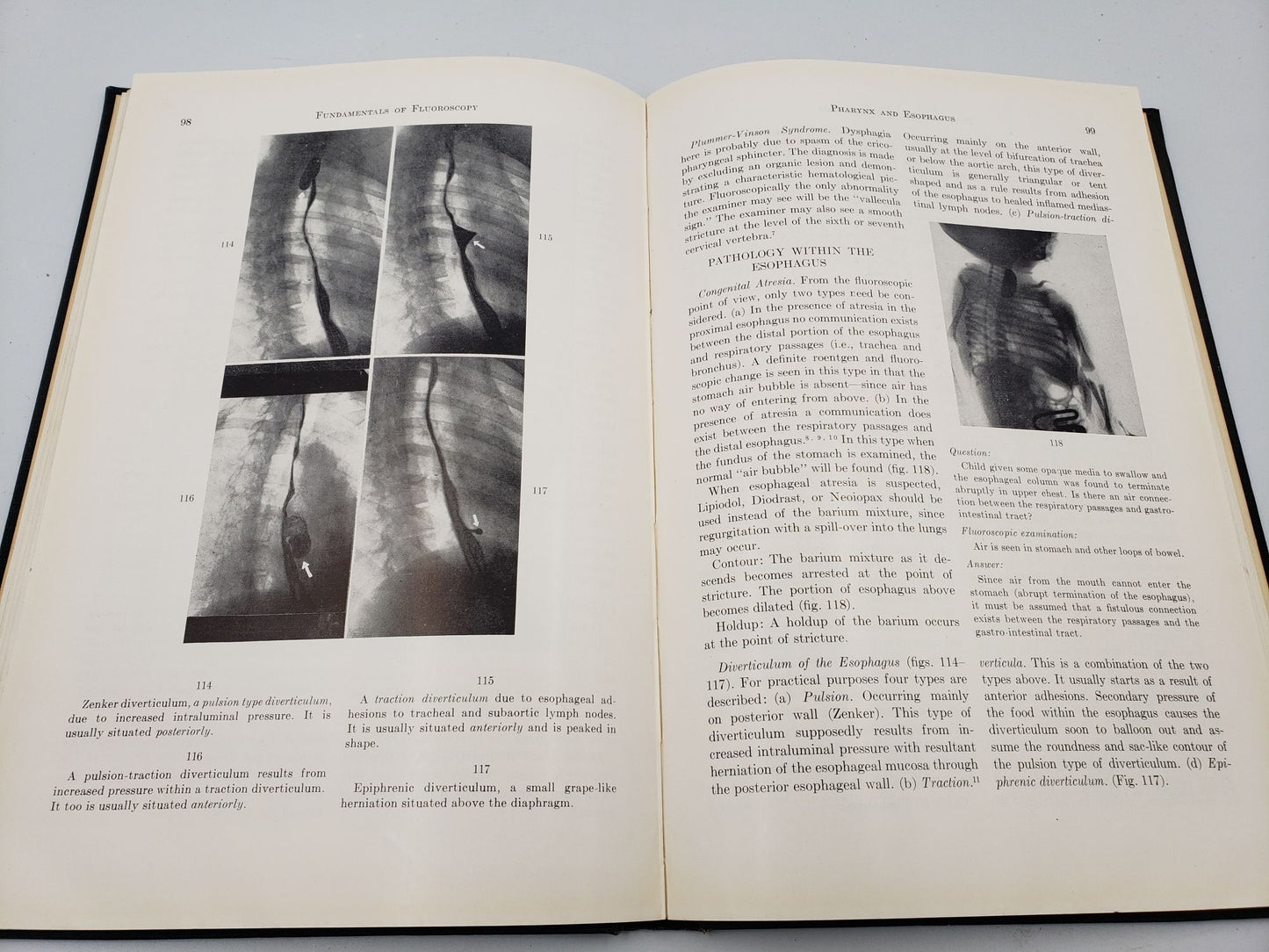 Fundamentals Of Clinical Fluoroscopy: With Essentials of Roentgen Interpretation