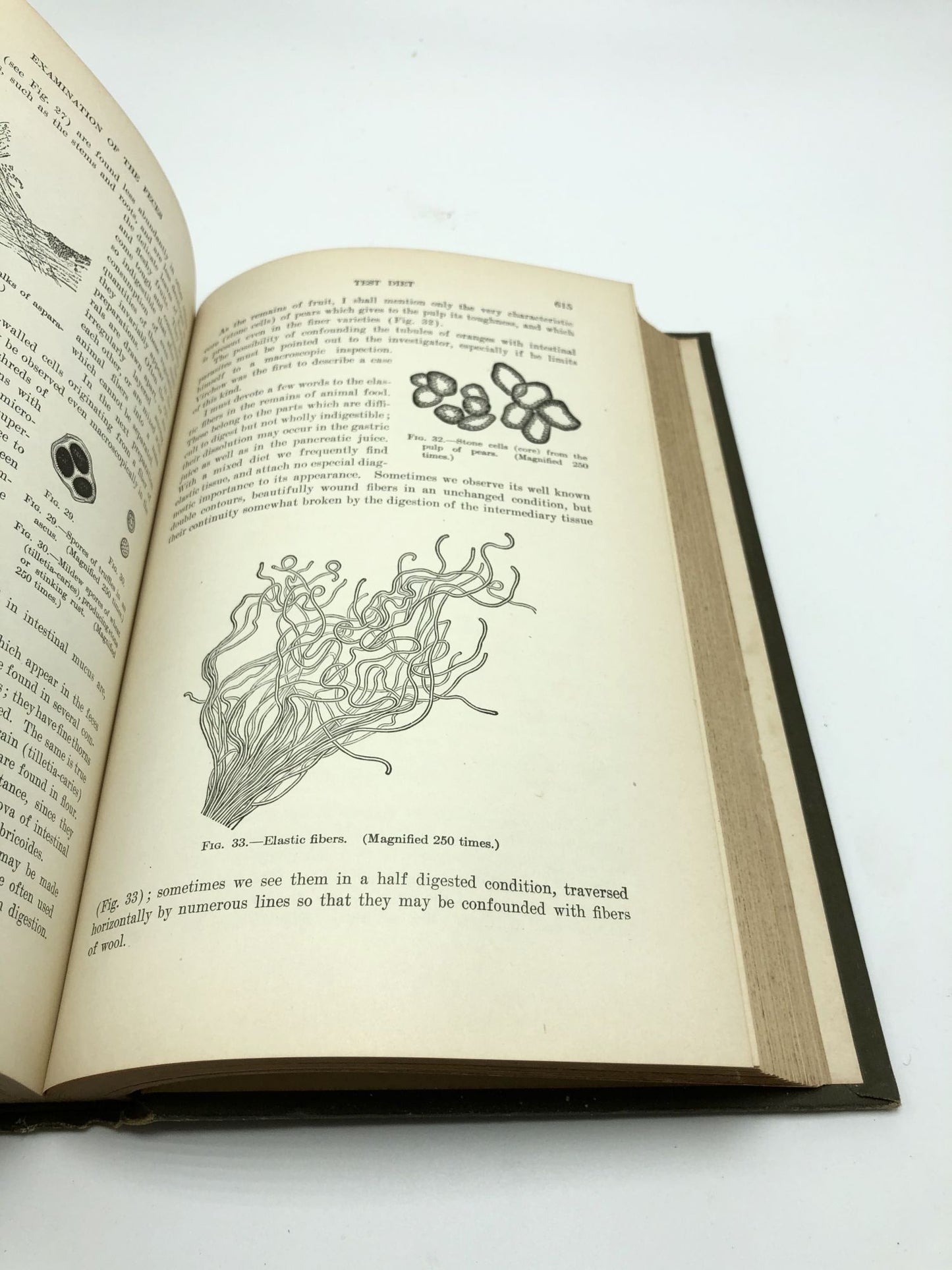 Diseases of the Digestive System