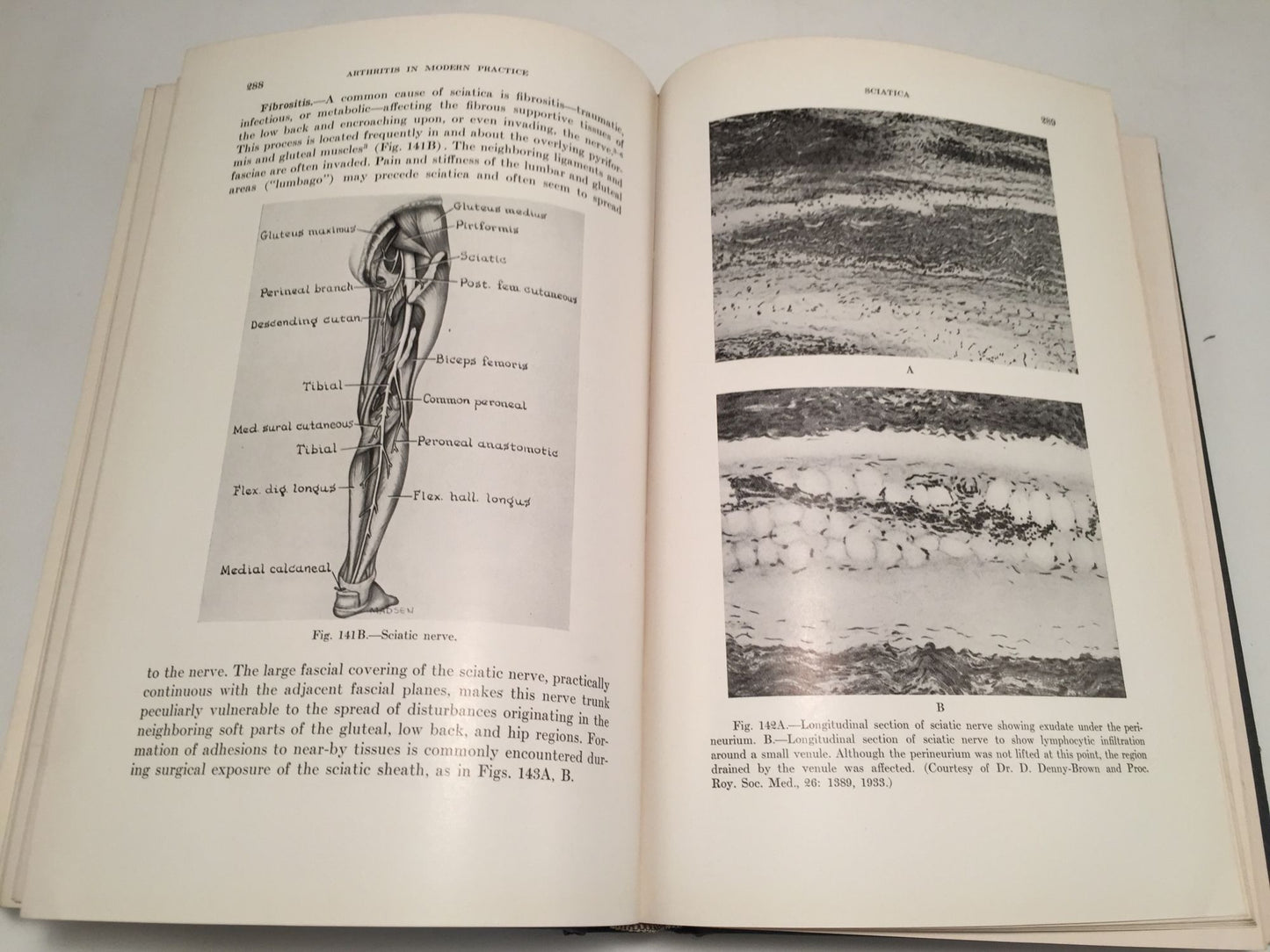 Arthritis in Modern Practice: The Diagnosis and Management of Rheumatic and Allied Conditions