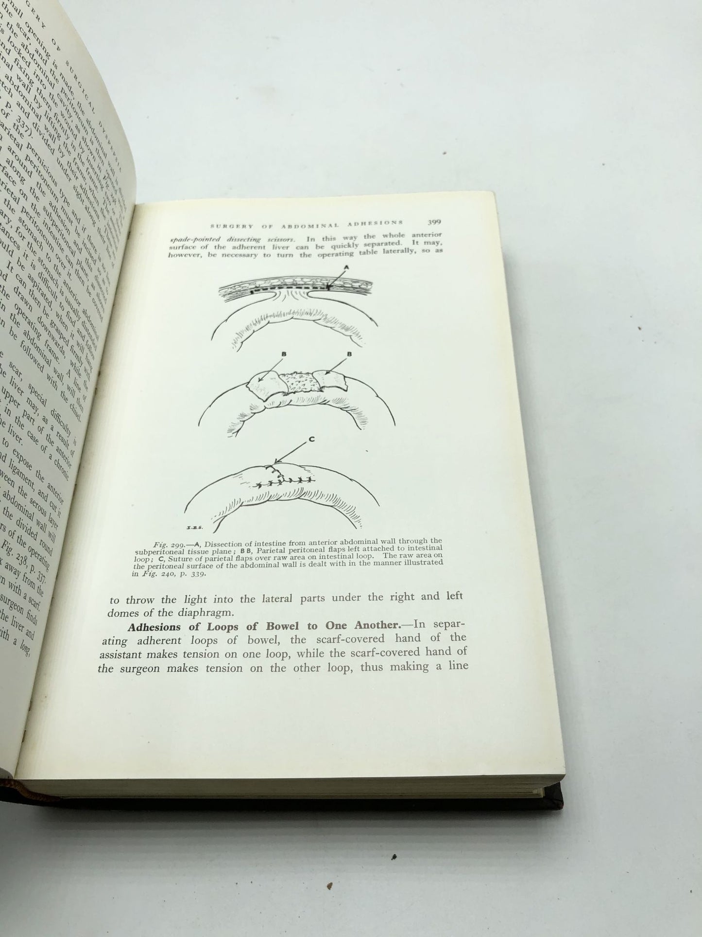 The Surgery of the Alimentary Tract